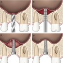 바른정치과의원 이미지