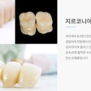 다이아몬드치과기공소 이미지