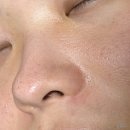 왕건이 | 올리브영 세일 | 메디필 피지클리너 왕건이 피지 녹인 초대박 후기