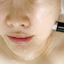 강남피부관리 성형후 붓기빼기 효과좋은 더마힐스에스테틱 후기
