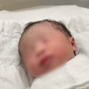 또랑슈퍼 | [출산 일기] 분당제일 여성병원 응급 제왕분만 (특실 후기 & 제왕 회복기간)