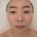 신대한엘피지제1 | 엘피지오스타필드빌리지운정점에서 받은 겨울철 피부관리 후기 써마웨이브 페이스관리