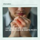 일등정형외과의원 | 꾸준한 관절 관리가 필요한 시점에서 일상 생활 속에서 점검해야 할 관절움직임 특징 분석
