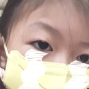 연세참빛안과의원 이미지