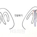 에이치에스의원 이미지