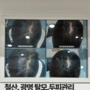 광명하나약국 | 철산역 주변 광명두피관리잘하는 곳 | 닥터포헤어 광명점