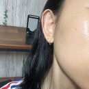 첨단메디칼약국 | 약국앰플로 유명한 엑소프록실 시카엑소메소드앰플 후기 :: 피부광채, 수분 미백 기능성 고농축 앰플 추천