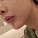 연제사우나 | 부산 연제구 피부과 물광주사 주의사항 후기