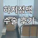 클라리네 | 하지정맥류 수술 후기 클라리베인, 레이저 수술