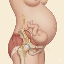 대성세이프티 | 임신 32주, "악!" 소리 나는 엉덩이 통증 '환도선다' 좌골신경통과 안전한 침 치료법