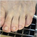 대덕대로168번길 | 대전 도안동 발톱무좀 노란발톱 관리 잘하는 네일의아침 후기