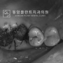 동암튼튼의원 네이버블로그