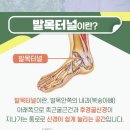 누리덴 네이버블로그