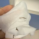 더모아뷰티 | 울산 동구 아이라인 문신제거 모아뷰티 색소지우개 후기