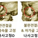 미병원