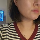 오르세윤의원 | 청담동리프팅 쓰리딥 잘 하는 곳 다녀온 후기 : 관리의 중요성