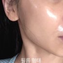 편안우리약국 | 지피덤 DVP 필름 마스크팩 | 약국화장품 홈케어 끝판왕, 필오프 랩핑으로 피부톤 살린 후기