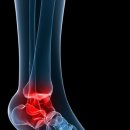 초이스병원 이미지