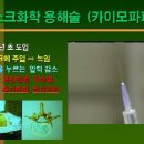 허리디스크병 - 치료 (8) / 간접적 수술법의 종류 및 발자취 이미지