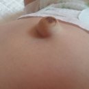 생후 한달 배꼽 모양 이미지