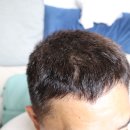 가락온누리약국 | 판토모나 샴푸, 약국 지성용 탈모샴푸 1개월 솔직 사용 후기