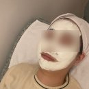 노란케어119 | 진주 피부관리 충무공동에스테틱 영화로운 에스테틱&amp;헤드스파 후기