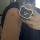 휴요양병원 | 휴병원에서 저렴하게 백일해 예방접종💉 (건강보험심사평가원 참고)