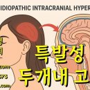 기맥한의원 | 특발성 두개내 고혈압 치료 후기 - 사암침법, 사암오행침, 오행침, 정통사암침