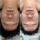 예쁘제 | 순천 남자피부관리 윤곽관리 까지 한번에 해결하는 곳 예쁘제이