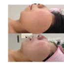 (주)스킨앤바디 | 동래피부관리의 완벽한 솔루션, 비본 스킨앤바디 방문 후기