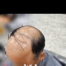 본모발