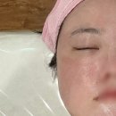 강남 에스테틱 안면홍조 문제성피부 고민으로 찾은 공간 후기