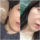 (주)위드트랜스 | 대연동 에스테틱 "제니룸스킨위드바디" 여드름관리 후기 🐛