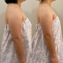 예원피부샾 | 다산 피부관리실/미올뷰티/신부관리/뼈말라 팔뚝 다이어트 받고왔어요~✨