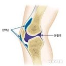 무릎 관절의 증상과 치료방법 이미지