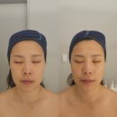 배곧파출소 | [시흥/배곧] 배곧피부관리 썸뷰티크 듀얼테트라로 윤곽수분관리 진심 너무너무 추천 신세계 영접