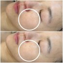 드림산업안전 | 구의피부관리 올가드림뷰티 구의점 모공디톡스관리 후기