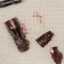 우리부부치과의원 | 춘천치과? 환자가 의사를 못 믿는 이유 (과잉진료, 덤터기)