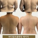 헤드스파제이