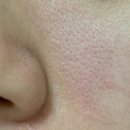 100 | 브이티 리들샷 100 3주 사용 후기