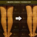 웰빙체형관리 이미지