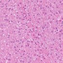 MS. & DOG | 젊은 개에서 장기간 지속된 중증 간수치 상승과 만성 간질환 정밀 진단 사례