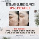 천안피부관리 더레이디뷰티 환절기 여드름관리 솔직후기