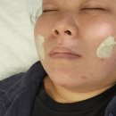 (주)브이지 | 시흥 예신관리 이중턱관리 세레누 피부&amp;왁싱 시흥점 에서 쏙프팅 제로브이 후기