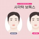 라온셀의원 네이버블로그