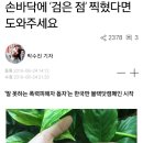 손바닥에 '검은 점' 찍혔다면 도와주세요 이미지