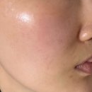 (주)메디율 | 메디율 율무팩 천연곡물팩 모공관리 화이트헤드 각질고민 후기