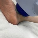 원주센트럴정형외과 네이버블로그