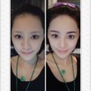 에비뉴의원 이미지