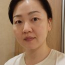 홈레이저 뷰티디바이스 퓨라셀미인 후기, 프락셔널부터 물광초음파 고주파까지